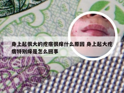 身上起很大的疙瘩很痒什么原因 身上起大疙瘩特别痒是怎么回事