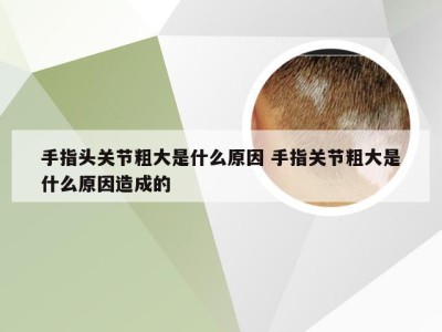 手指头关节粗大是什么原因 手指关节粗大是什么原因造成的