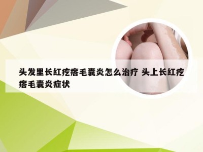 头发里长红疙瘩毛囊炎怎么治疗 头上长红疙瘩毛囊炎症状