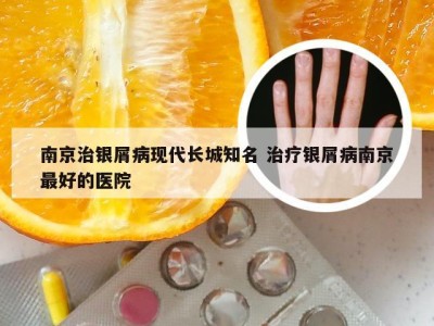 南京治银屑病现代长城知名 治疗银屑病南京最好的医院