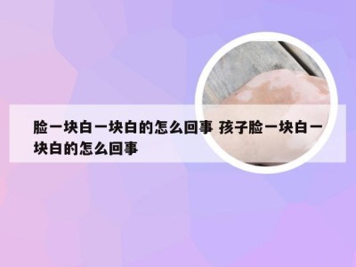 脸一块白一块白的怎么回事 孩子脸一块白一块白的怎么回事