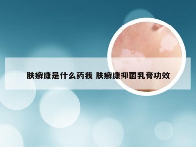 肤癣康是什么药我 肤癣康抑菌乳膏功效