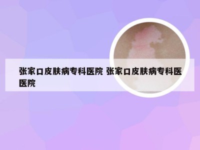 张家口皮肤病专科医院 张家口皮肤病专科医医院