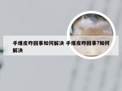 手爆皮咋回事如何解决 手爆皮咋回事?如何解决