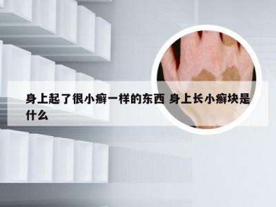 身上起了很小癣一样的东西 身上长小癣块是什么