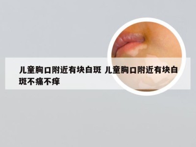 儿童胸口附近有块白斑 儿童胸口附近有块白斑不痛不痒