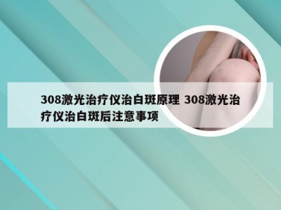 308激光治疗仪治白斑原理 308激光治疗仪治白斑后注意事项