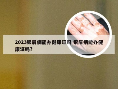 2023银屑病能办健康证吗 银屑病能办健康证吗?