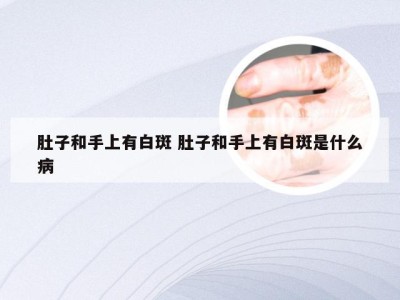 肚子和手上有白斑 肚子和手上有白斑是什么病