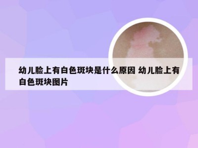 幼儿脸上有白色斑块是什么原因 幼儿脸上有白色斑块图片