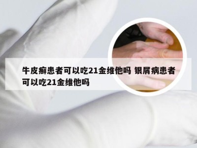 牛皮癣患者可以吃21金维他吗 银屑病患者可以吃21金维他吗