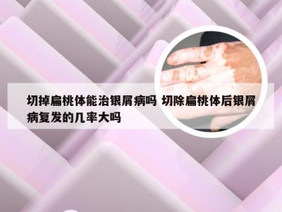 切掉扁桃体能治银屑病吗 切除扁桃体后银屑病复发的几率大吗