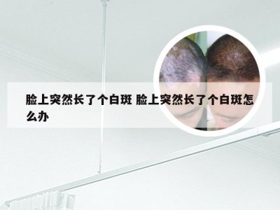 脸上突然长了个白斑 脸上突然长了个白斑怎么办