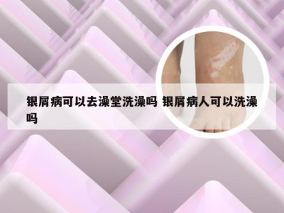 银屑病可以去澡堂洗澡吗 银屑病人可以洗澡吗