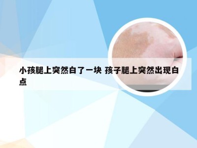 小孩腿上突然白了一块 孩子腿上突然出现白点