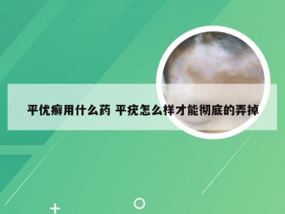 平优癣用什么药 平疣怎么样才能彻底的弄掉