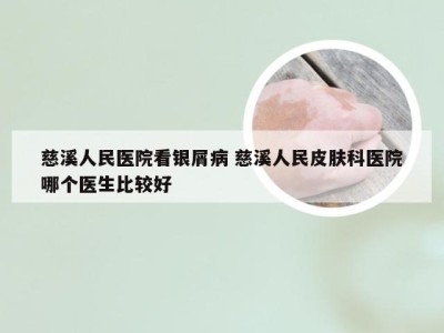 慈溪人民医院看银屑病 慈溪人民皮肤科医院哪个医生比较好