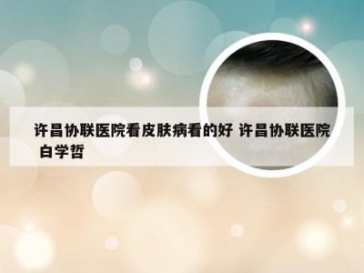 许昌协联医院看皮肤病看的好 许昌协联医院 白学哲