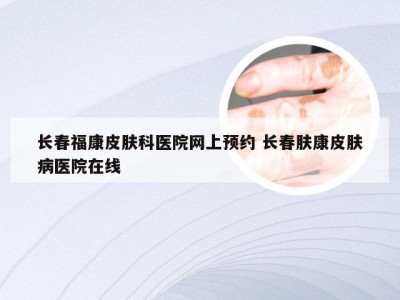 长春福康皮肤科医院网上预约 长春肤康皮肤病医院在线