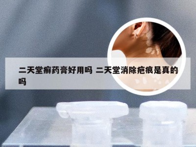 二天堂癣药膏好用吗 二天堂消除疤痕是真的吗