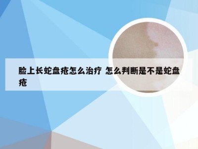 脸上长蛇盘疮怎么治疗 怎么判断是不是蛇盘疮