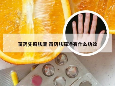 苗药先癣肤康 苗药肤藓净有什么功效