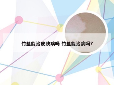 竹盐能治皮肤病吗 竹盐能治病吗?