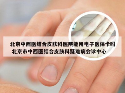 北京中西医结合皮肤科医院能用电子医保卡吗 北京市中西医结合皮肤科疑难病会诊中心