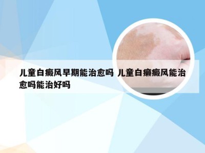 儿童白癜风早期能治愈吗 儿童白癞癜风能治愈吗能治好吗