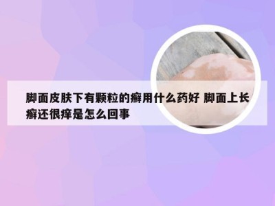 脚面皮肤下有颗粒的癣用什么药好 脚面上长癣还很痒是怎么回事