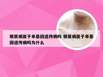 银屑病属于单基因遗传病吗 银屑病属于单基因遗传病吗为什么