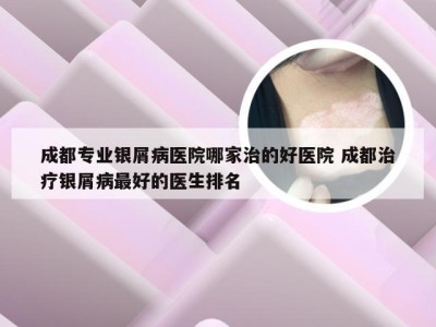 成都专业银屑病医院哪家治的好医院 成都治疗银屑病最好的医生排名