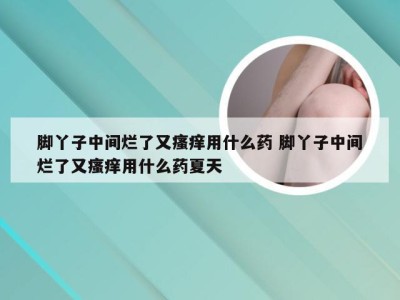 脚丫子中间烂了又瘙痒用什么药 脚丫子中间烂了又瘙痒用什么药夏天