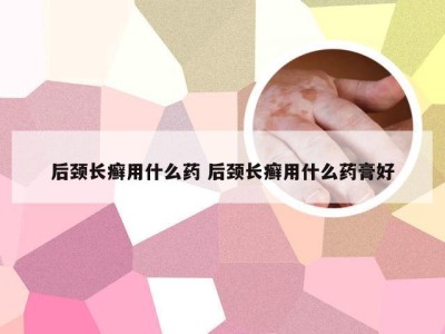 后颈长癣用什么药 后颈长癣用什么药膏好