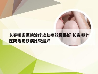 长春哪家医院治疗皮肤病效果最好 长春哪个医院治皮肤病比较最好