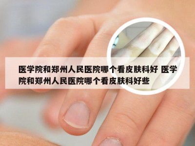 医学院和郑州人民医院哪个看皮肤科好 医学院和郑州人民医院哪个看皮肤科好些