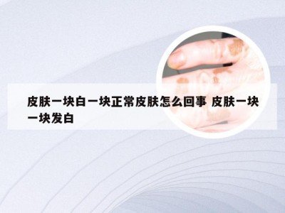 皮肤一块白一块正常皮肤怎么回事 皮肤一块一块发白