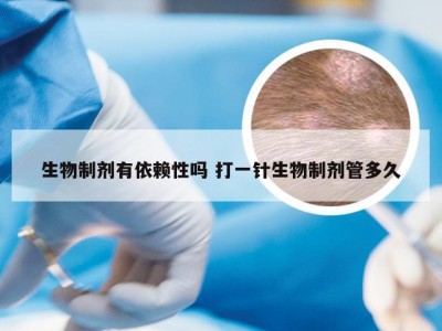 生物制剂有依赖性吗 打一针生物制剂管多久