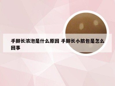 手脚长浓泡是什么原因 手脚长小脓包是怎么回事