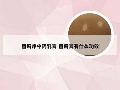 菌癣净中药乳膏 菌癣膏有什么功效