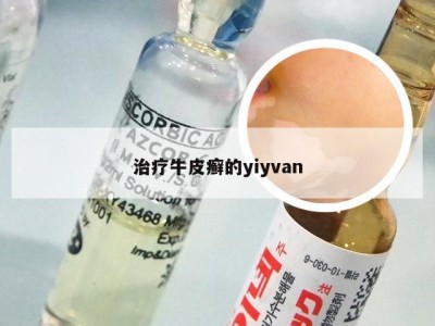 治疗牛皮癣的yiyvan