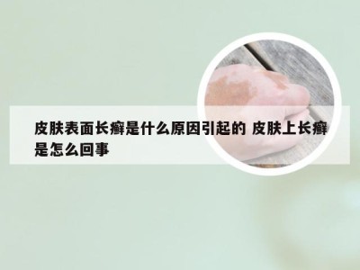 皮肤表面长癣是什么原因引起的 皮肤上长癣是怎么回事