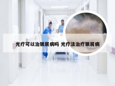 光疗可以治银屑病吗 光疗法治疗银屑病