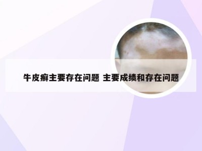 牛皮癣主要存在问题 主要成绩和存在问题