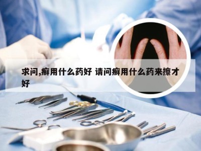 求问,癣用什么药好 请问癣用什么药来擦才好