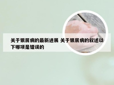 关于银屑病的最新进展 关于银屑病的叙述以下哪项是错误的