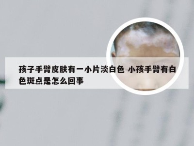 孩子手臂皮肤有一小片淡白色 小孩手臂有白色斑点是怎么回事