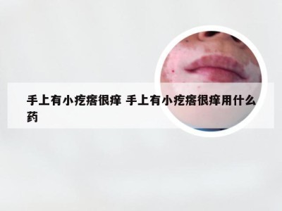 手上有小疙瘩很痒 手上有小疙瘩很痒用什么药