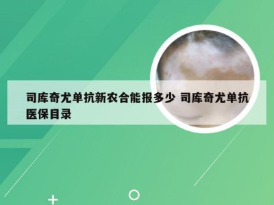 司库奇尤单抗新农合能报多少 司库奇尤单抗医保目录