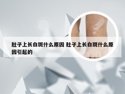 肚子上长白斑什么原因 肚子上长白斑什么原因引起的